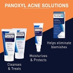 PanOxyl Acne Foaming Wash Benzoyl Peroxide 10% Maximum Strength Antimicrobial, 5.5 Oz - Image 5