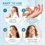 KEYCONCEPTS Pimple Patches for Face (120 Patches), Hydrocolloid Acne Patches with Tea Tree Oil - Pimple Patch Zit Patch and Pimple Stickers - Hydrocolloid Acne Dots for Acne - Zit Patches - Image 5